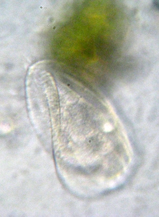 Protozoi del muschio: Phacodinium metchnicoffi ?